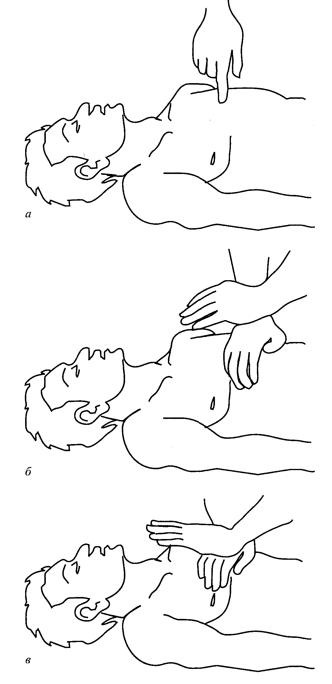 Положение рук при непрямом массаже сердца